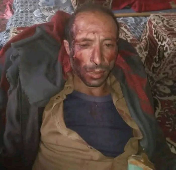 مقتل وإصابة أربعة من أسرة واحدة في عراك دموي على قطعة أرض بصنعاء