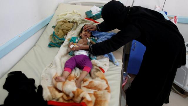 أغلبها بمناطق سيطرة الحوثيين.. الأمم المتحدة تعلن ارتفاع حالات الإصابة بالكوليرا في اليمن