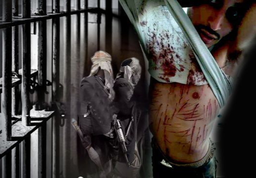 مليشيا الحوثي تعذّب 23 مدنيًا بينهم أطفال منذ سبتمبر في البيضاء