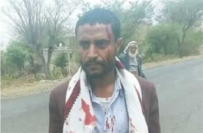 انفلات أمني في إب.. اختطاف مسن وقتيل بنزاع قبلي وسط صمت سلطات الحوثيين
