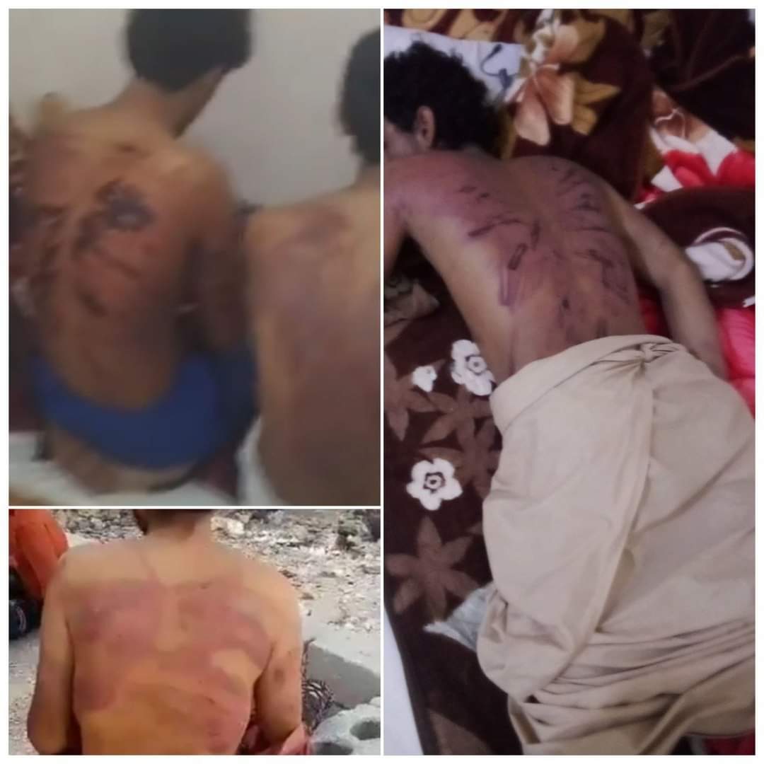 تعذيب سبعة مواطنين.. القشّة التي ستقصم ظهر العلاقات السياسية والدبلوماسية اليمنية العُمانية