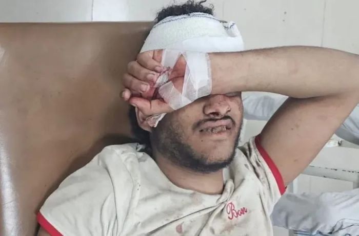 قناص حوثي يصيب شابًا في رأسه شرق تعز