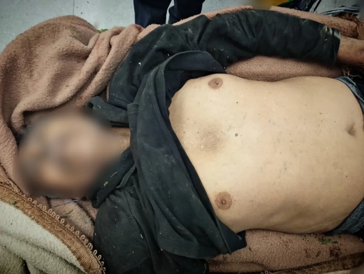 تعز.. قناصة الحوثي يزهقون روح مسن في حي الزهراء