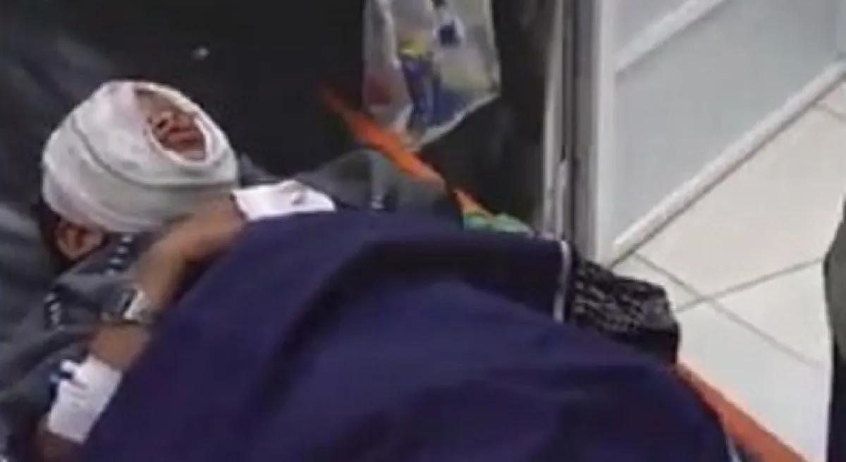 إصابة طفل في تعز بمقذوف حوثي بعد يومين من استشهاد آخر