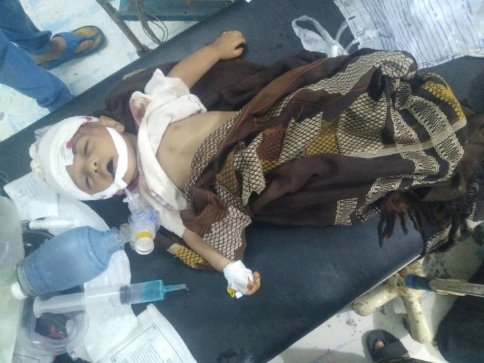 طفل رضيع يفارق الحياة متأثرًا بجراحه في قصف حوثي بتعز