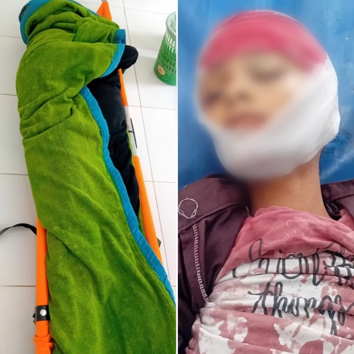 استشهاد امرأة وطفل وإصابة 6 مدنيين في قصف لمسلحي الحوثي جنوب شرقي تعز