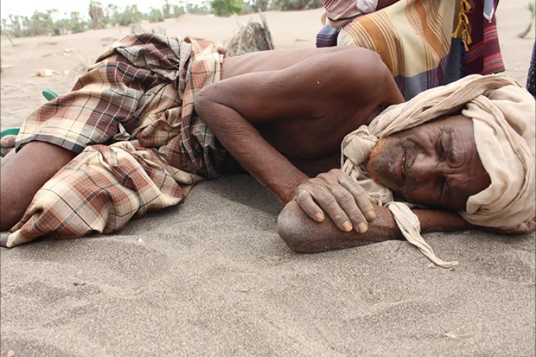 تحذيرات من مجاعة كارثية.. الفاو وبرنامج الأغذية العالمي يكشفان نقاط الجوع الساخنة في العالم