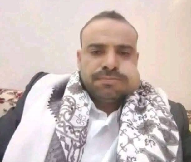 بأسلوب العصابات... الحوثيون يغتالون شيخاً قبلياً وسط عمران