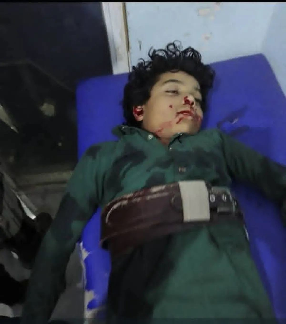 إب.. مقتل طفل برصاص مسلح حوثي في سوق شعبية