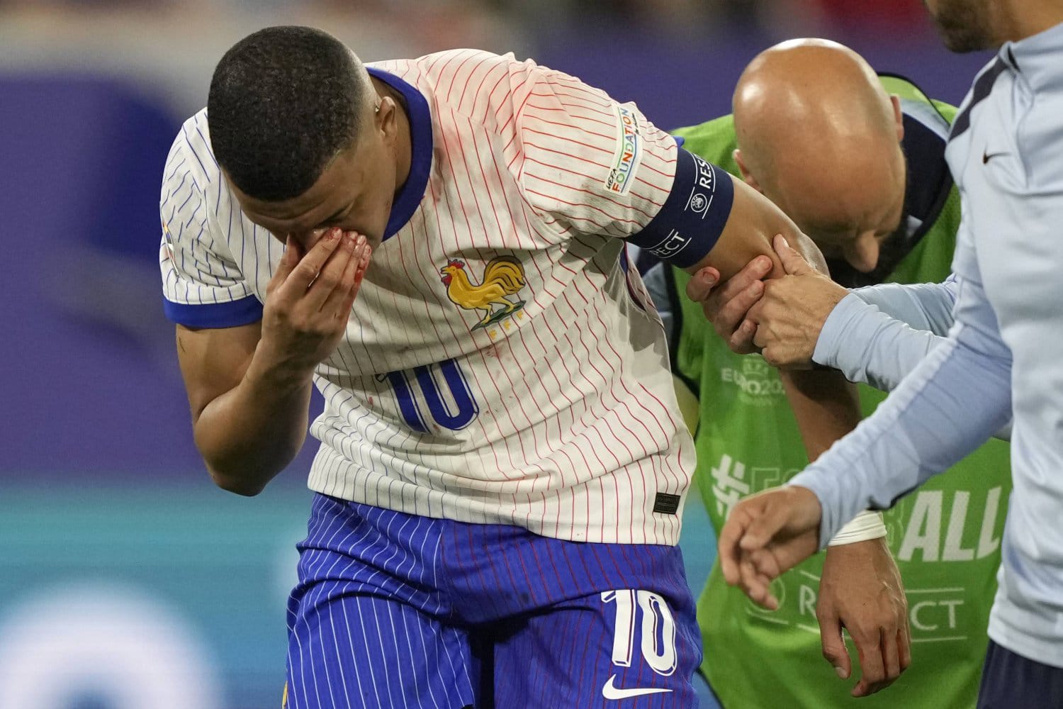 مدرب المنتخب الفرنسي يعلن تعرض مبابي لإصابة كبيرة