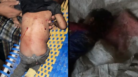 جريمة جديدة للحوثيين في تعز.. استشهاد طفلة وإصابة شقيقها بقصف همجي