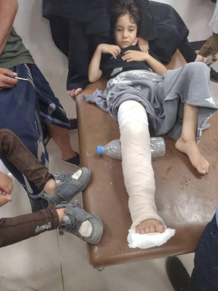 قناص حوثي يصيب مدنيين في تعز أثناء تعبئة المياه