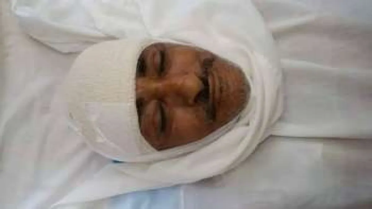 استشهاد شخصين وإصابة طبيب بتدمير حوثي لسيارة إسعاف في جبل صبر بتعز