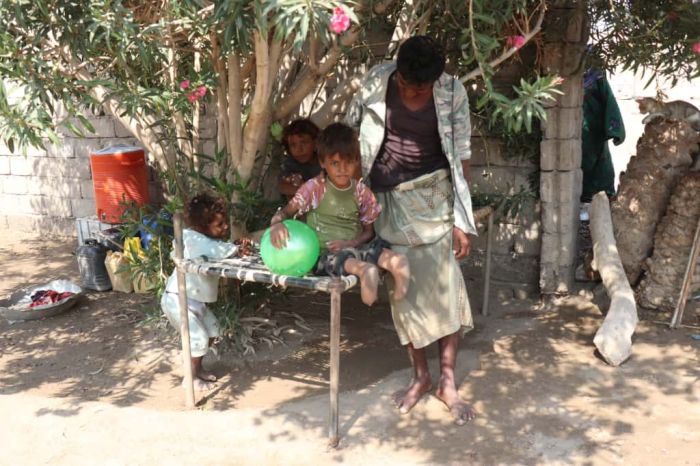 في يوم الطفل العالمي.. ألغام الحوثي تطفئ براءة أطفال الحديدة وتحوّل أحلامهم إلى أطراف مبتورة