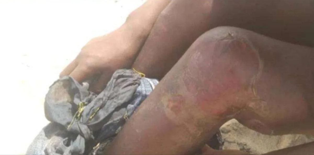 معتقلات سرية في اليمن.. تحذيرات من تفشي التعذيب والابتزاز بحق المهاجرين في أبين وشبوة