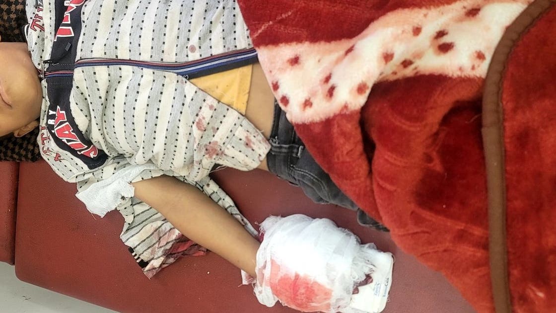إصابة طفل برصاص قناص حوثي في تعز