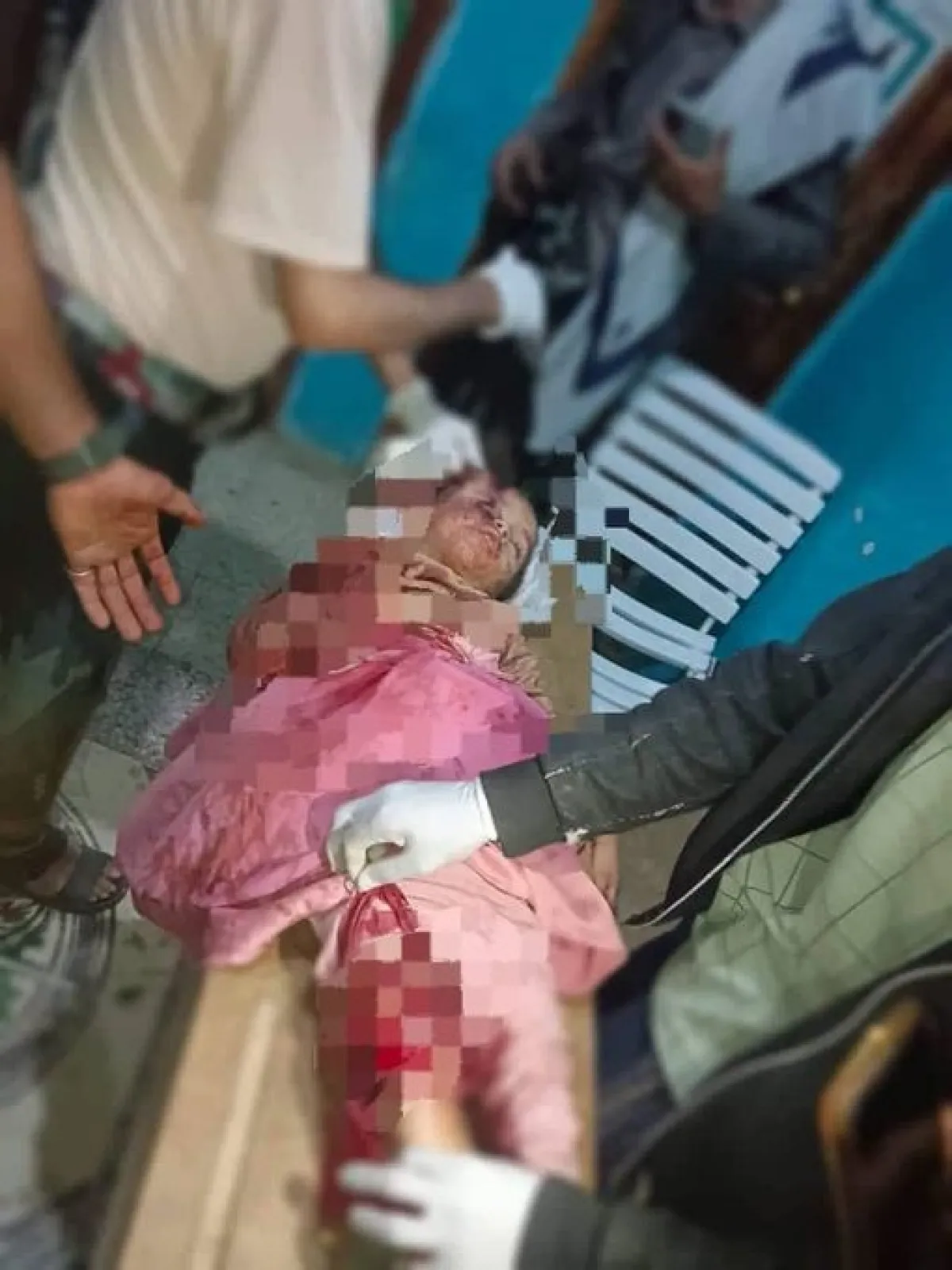 قذائف الحوثيين وقناصتهم تحصد مدنياً وتصيب طفلة وامرأة في ريف تعز