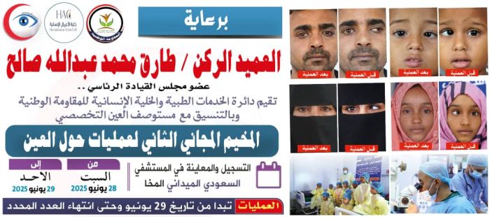 المقاومة الوطنية تُجري الاستعدادات النهائية لإطلاق مخيم جراحي مجاني لعلاج الحَوَل في المخا