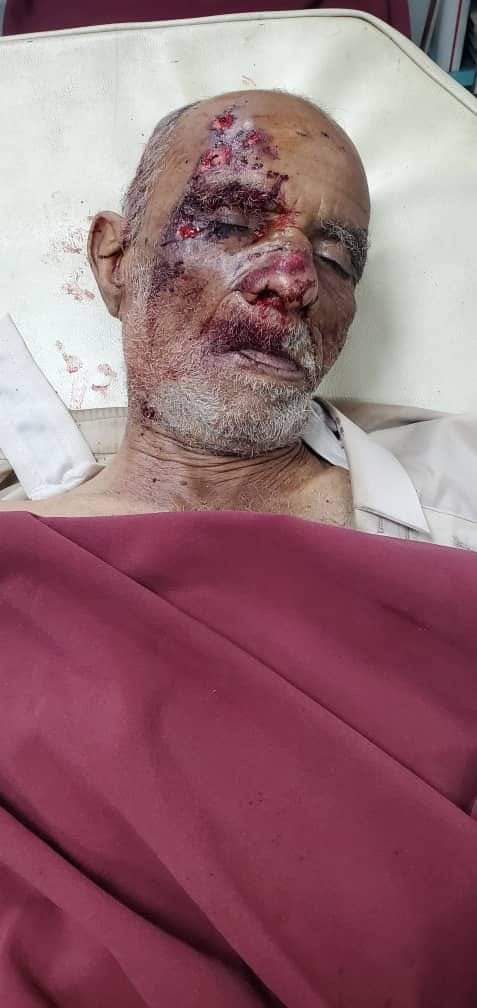 وفاة مُسن بحادث سير مروّع شمالي صنعاء صورة