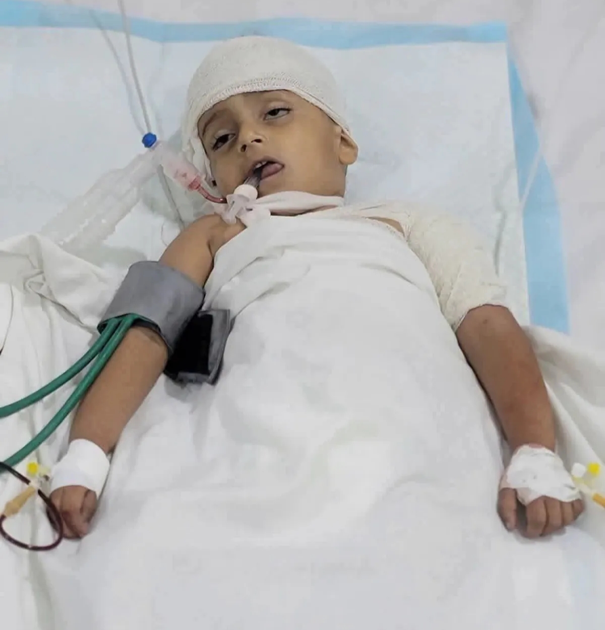 قصف عشوائي في تعز يسفر عن وفاة طفل وإصابة خمسة مدنيين