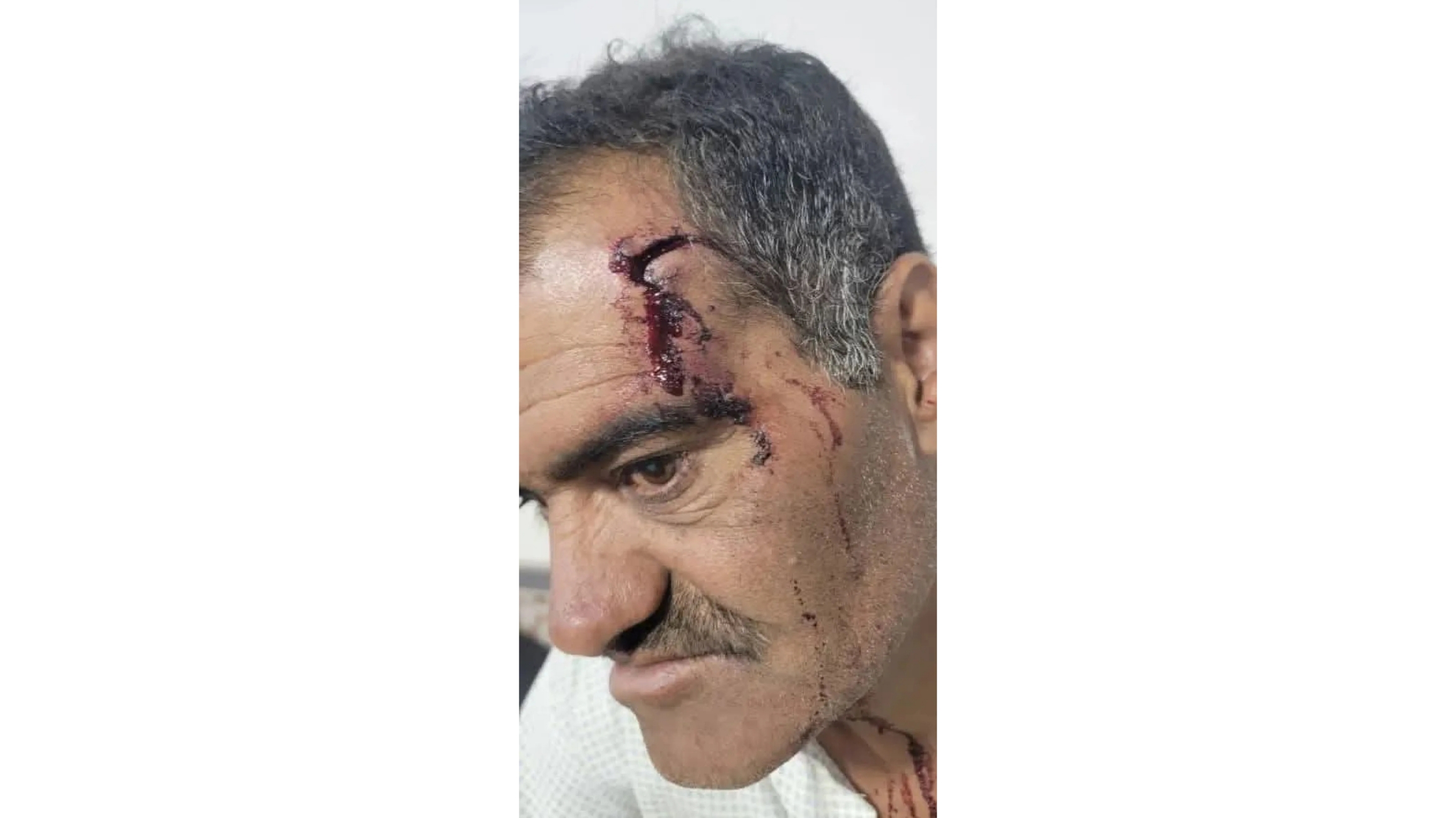 اعتداء وحشي على عاقل حارة 