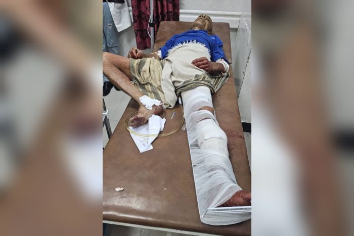مسن خمسيني ضحية جديدة لقناصة الحوثي في حي الشرف بتعز