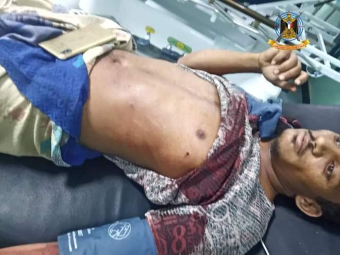 المدفعية الحوثية تقتل طفلاً وتصيب والده غربي قعطبة بالضالع