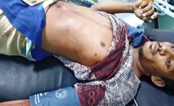 قصف حوثي يسفر عن استشهاد طفل وإصابة والده شمال الضالع