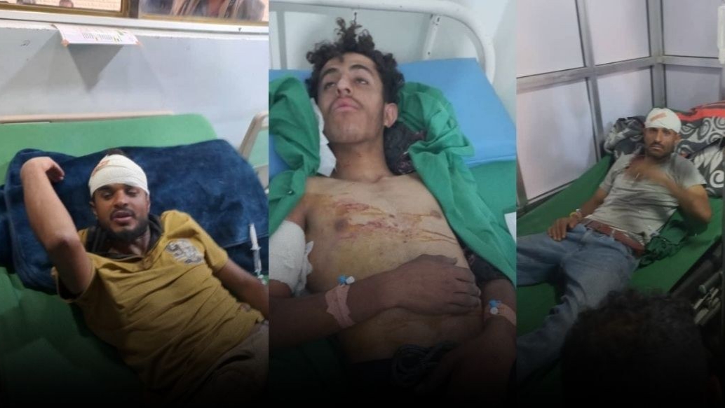 إصابة أربعة من أسرة واحدة برصاص مليشيا الحوثي في نقطة جباية شمال الضالع