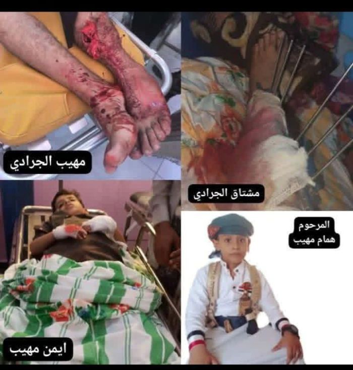 مأساة في نشطون.. طفل يُقتل وجرحى في إطلاق نار عشوائي بسبب خلاف على "القات"