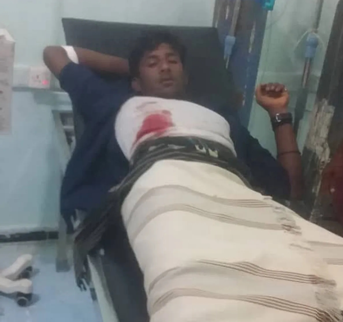 إصابة مدني بقصف حوثي على مخيم نازحين في الحديدة